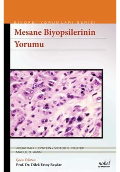 Biyopsilerin Yorumu: Mesane- Nobel Tıp Kitabevleri