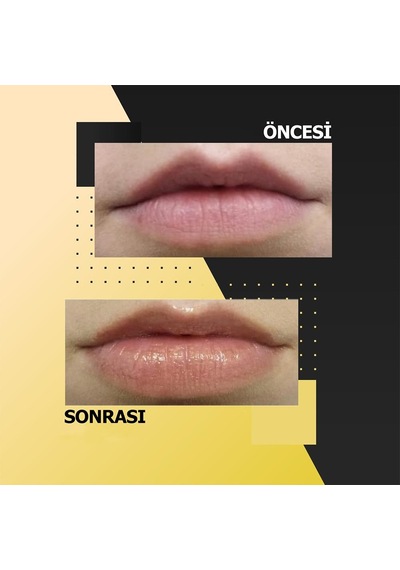 Too Be Beauty  & Volumizer Lip Care