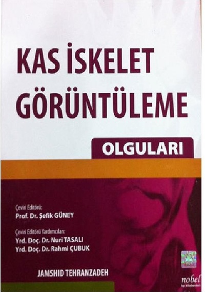 Kas Iskelet Görüntüleme Olguları
