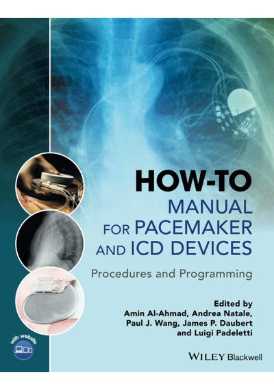 How-to Manual For Pacemaker And Icd Devices: Procedures And Programming