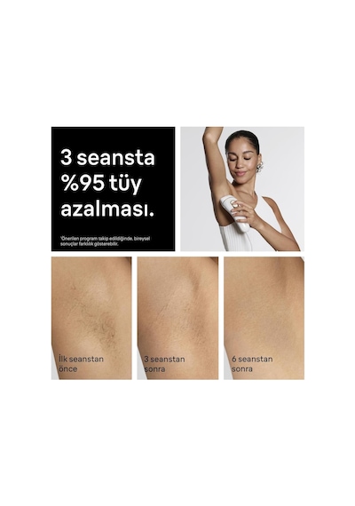 Silk Expert Pro5 Pl5137 Yeni Nesil Ipl, Lazer Epilasyon Aleti