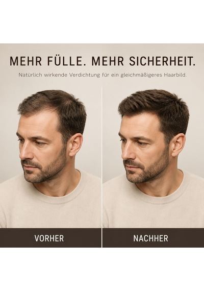 Hair Fiber Sprey 150ml Mat Brown