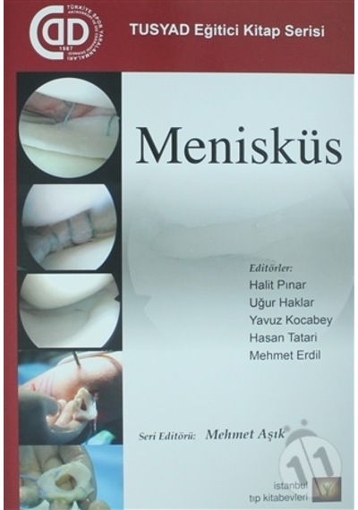Menisküs