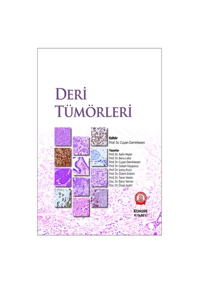 Deri Tümörleri