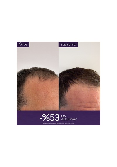 Saç Dökülmesine Karşı Serum 50ml