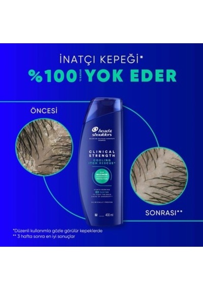 Head&shoulders Head & Shoulders Clinical Strength Cooling Itch Rescue Kaşıntı Karşıtı Şampuan 400