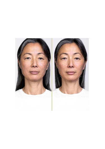 Shiseido Vital Perfection Night Concentrate - Gece Serumu 40 Ml
