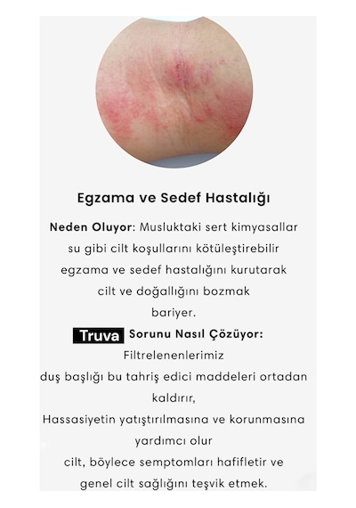 Truva 10 Adet Yedek Filtreli Beyaz Renk Masaj Özellikli Duş Başlığı Krom