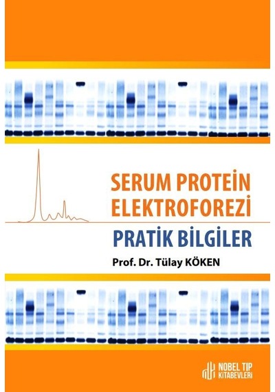 Serum Protein Elektroforezi: Pratik Bilgiler