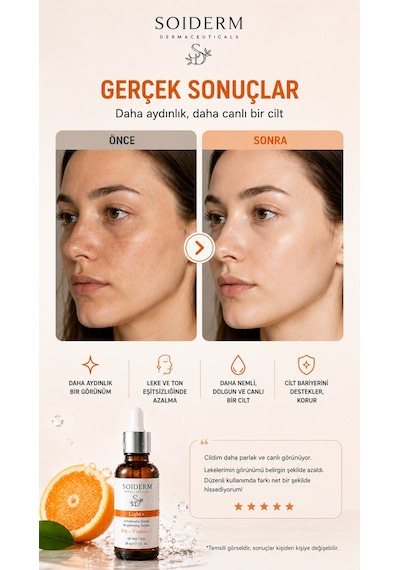Soiderm Light+ Aydınlatıcı Serum - Hyalüronik Asit + Vitamin C