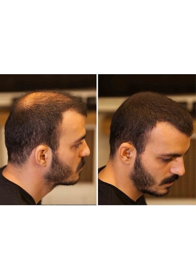 2 Adet Fıxplant 28 Gr Orta Kahve Saç Tozu - Kargo Bedava