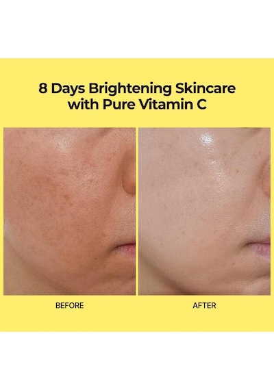 Varı Hope 8 Days Brıghtenıng Mask Wıth Pure Vıtamın C 5ea C Vitamini İçeren Aydınlatıcı Ve Canlandırıcı Maske