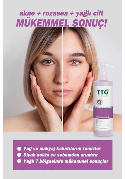 TTO Thermal Yağlı ve Karma Ciltler için Yüz Temizleme Jeli 2 x 200 ML