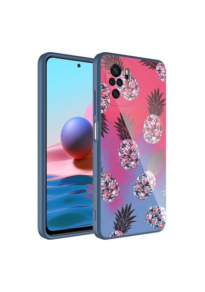 Xiaomi Poco M5s Kılıf Kamera Korumalı Desenli Sert Silikon Zore Epoksi Kapak NO3