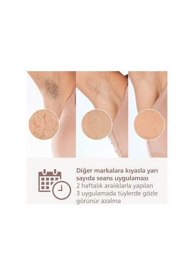 Philips Lumea 9900 Serisi Brı953/01 Ipl Tüy Alma Beyaz Renk Özellikli Cilt Temas