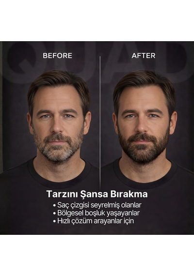 Saç Kapatıcı Pudra, Kahverengi, Unisex Saç Ve Sakal Dolgunlaştırıcı, Doğal Görünüm, 12gr