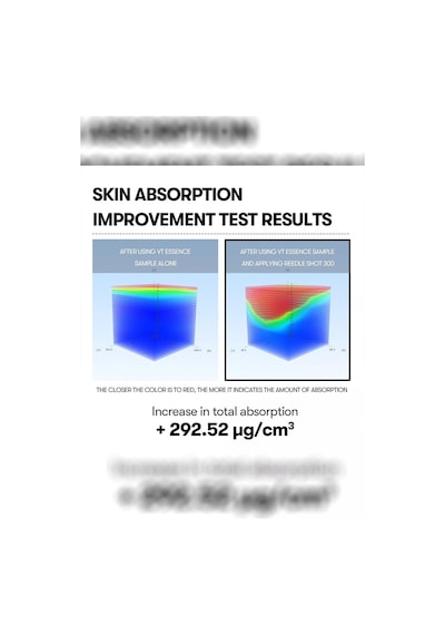 Vt Cosmetics Reedle Shot 300 Yüz Serumu 30ml
