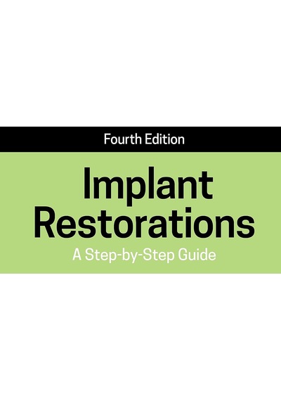 .atfredesignv2 .collapsed Expandtitletoggle Background-image: Url "" Top: 1.4rem Right: 0rem .atfredesignv2 .expanded Expandtitletoggle Background-image: Url "" Bottom: 1rem Right: 1.6rem Implant Restorations: A Step By Step Guide
