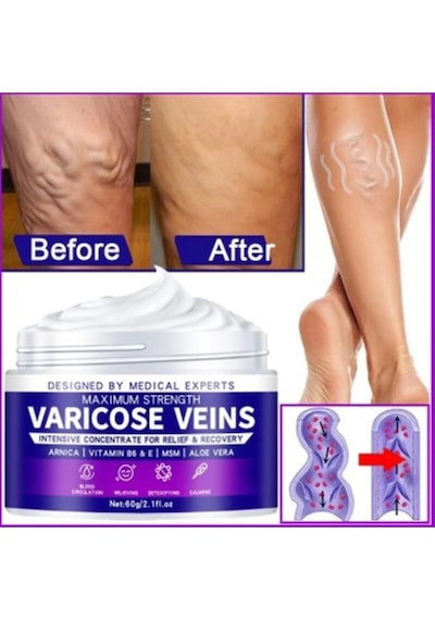 Strength Varicose Vein Kremi 100 Ml X 3 Adet