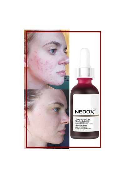 Cilt Yenileyici Cilt Tonu Eşitleyici Kırmızı Peeling Serum Aha %30 Bha %2 Ph % 3.5 Serum 30 Ml