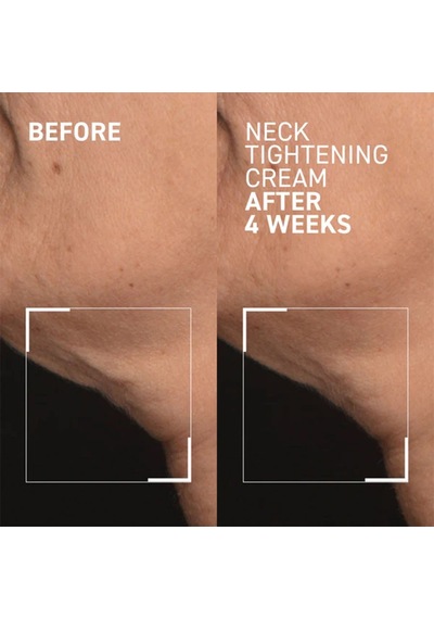 Dr.brandt Needles No More Neck Tightening Cream Sıkılaştırıcı Boyun Kremi
