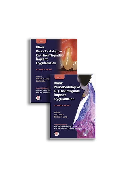 Klinik Periodontoloji Ve Diş Hekimliğinde İmplant Uygulamaları