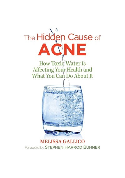 The Hidden Cause Of Acne: How Toxic Water Is Affecting Your Health And What You Can Do About It