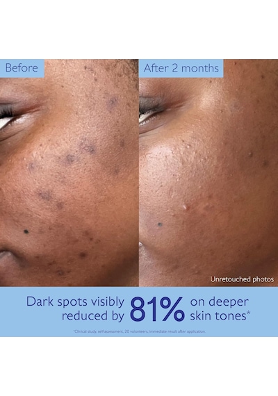 Vinoperfect Brightening Dark Spot Serum 50 Ml - 3522930004493