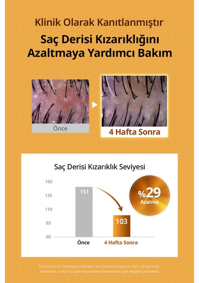 Saç Dökülmesi Karşıtı Ferahlatan Köklere Hacim Sunan Tonik Kundal Beer Yeast Extra Root Volume Tonic