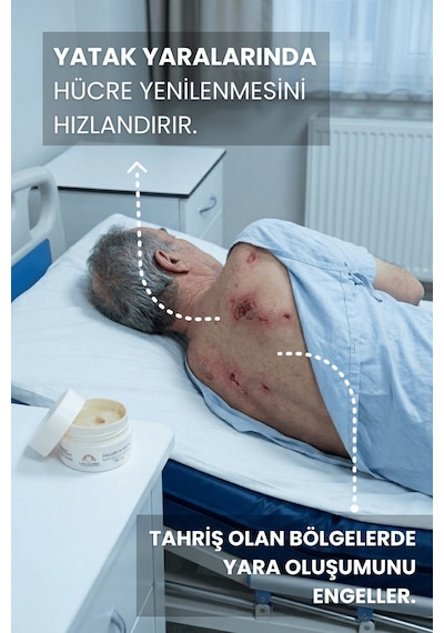 Laviaderm Decuderm Yatak Yarası ve Açık Yara Kremi 100 ML
