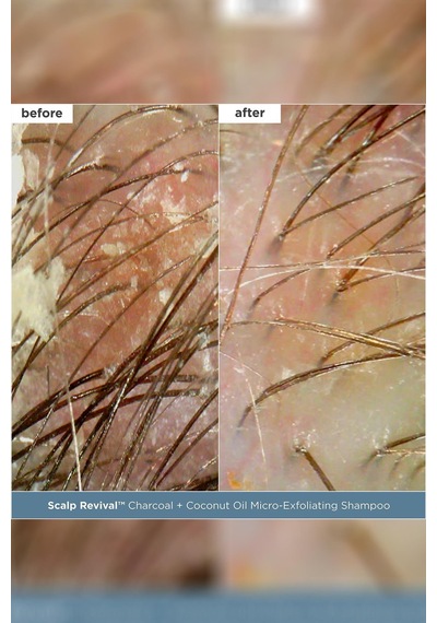 Briogeo Scalp Revival Saç Derisi Bakım Seti Seyahat Boyu