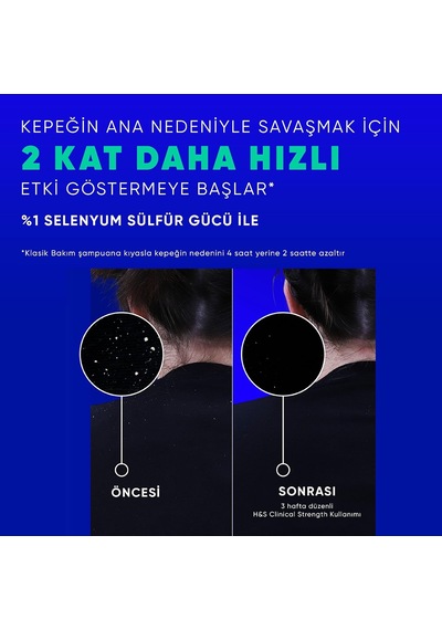 Head&shoulders Clinical Strength Cooling Itch Rescue Kaşıntı Karşıtı Şampuan 400 Ml