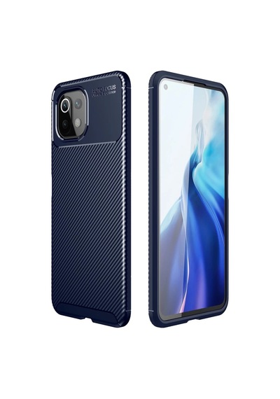 Xiaomi Mi 11 Lite Uyumlu Kılıf Auto Focus Karbon Kapak - Lacivert