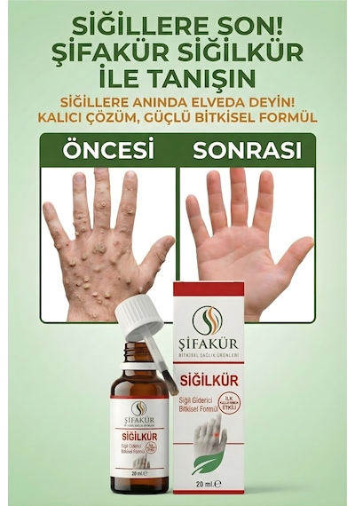 Siğilkür Siğil Giderici Bitkisel Solüsyon 20ml - Törpü Ve Koruyucu Pedli Tam Bakım Seti