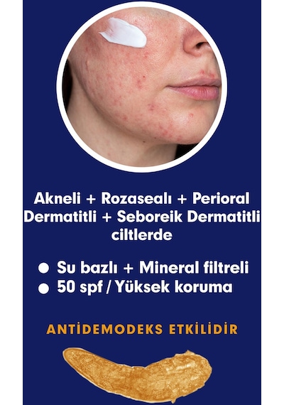 Tto Clinic Akneli ve Rozalı Ciltler için Çay Ağacı Yağlı Güneş Losyonu SPF50 100 ML