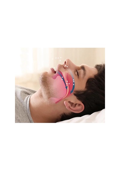 Rahat Uyku İçin Anti Snore Sleep Horlama Engelleyici Aparat Uyku Stoperi Hmngo48-ıeg4874d