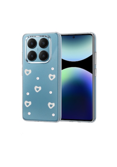 Redmi Note 14 Pro 4g Fiyonk Desenli Kapak - Desen 10 Bz8683140868024
