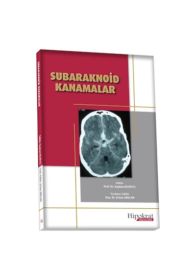 Subaraknoid Kanamalar