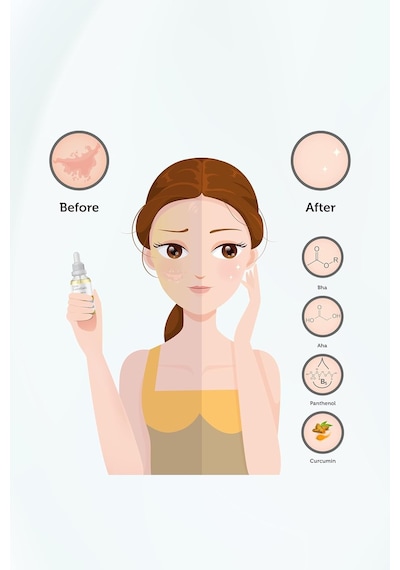 Tr Essentials Canlandırıcı&cilt Tonu Eşitleyici Yüz Peeling Serum 30ml %20 Aha,%2 Bha,%1 Curcumin