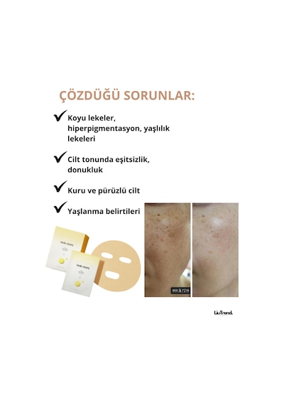 Varı Hope 8 Days Brıghtenıng Mask Wıth Pure Vıtamın C 5ea C Vitamini İçeren Aydınlatıcı Ve Canlandırıcı Maske