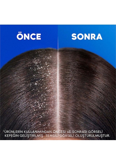 Head & Shoulders Mentol Ferahlığı 2in1 Şampuan 330 ML
