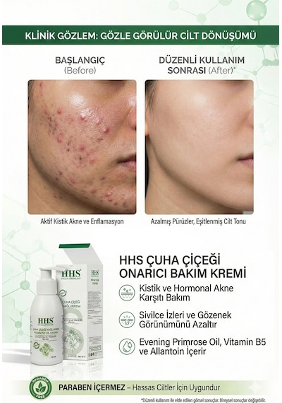 Hhs uha Çiçeği Yağlı Krem Parabensiz 100 ML