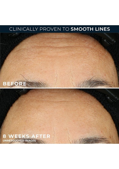 Retinol Correxion Line Smoothing Kırışıklık Karşıtı Kapsül Serum 10 Adet