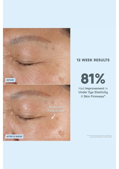 Nuface Super Vita- Niasinamidli C Vitamini Yüz Serumu 30 Ml Serumlar