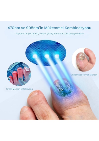 Shopttech 36w Katlanabilir Işık Cihazı El Ve Ayak Tırnağı İçin Led Fototerapi Lambası, Usb Şarjlı
