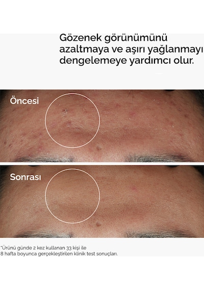 Niacinamide 10% + Zinc 1% - Leke Ve Gözenek Görünümü Karşıtı Serum 30ml