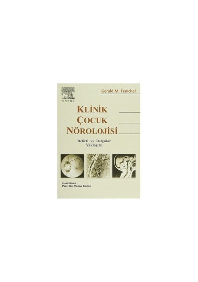 Klinik Çocuk Nörolojisi