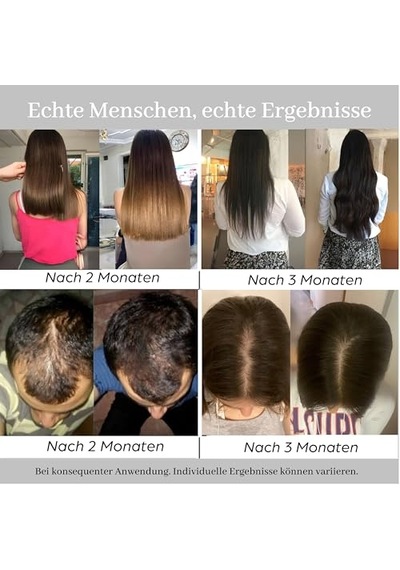 Yoğunlaşma Nane Saç Oluşumuna Yardımcı Saç Serumu Dökülme Karşıtı - Biotin, Keratin, Peptid, Procapil Saç V