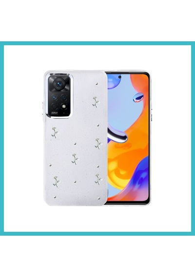 Bezos Redmi Note 11 Pro Uyumlu Fiyonk Desenli Kapak - Desen 4 Dfnbez