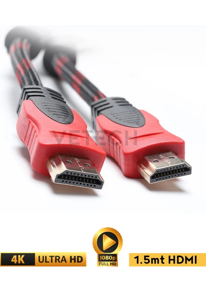 Vetech Hdmı Kablo 1.5 Metre Örgü Sargılı Dayanıklı Full Hd Televizyon / Monitör / Tv Hdmi Kablosu 1,5 Metre